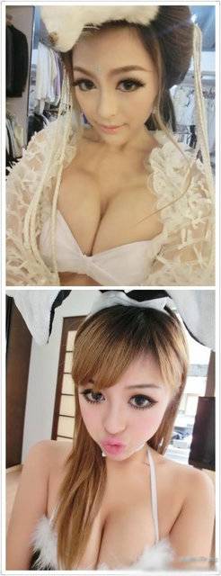 \